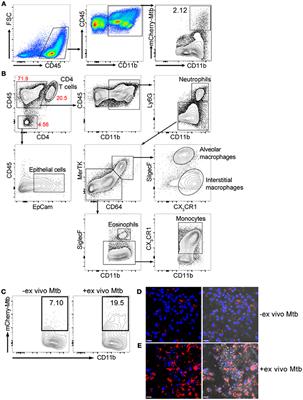 The Deconstructed Granuloma: A Complex High-Throughput Drug Screening Platform for the Discovery of Host-Directed Therapeutics Against Tuberculosis